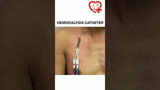 Hemodialysis catheter shorts shortspeed anatomy [upl. by Lapides]