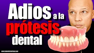 LA MEJOR FORMA de REEMPLAZAR TU PROTESIS DENTAL sin TENER MUCHO HUESO en las ENCÍAS [upl. by Ryley968]