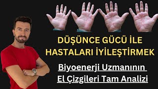 Düşünce Gücü ile Hastaları İyileştirmek  Biyoenerji Uzmanının El Çizgileri Tam Analizi [upl. by Sherl]