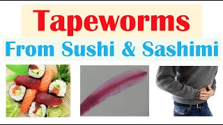 Fish Tapeworm Diphyllobothriasis Transmission Signs amp Symptoms Diagnosis Treatment Prevention [upl. by Domella]