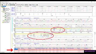 Heterozygous Indel Detection in Mutation Surveyor Part 1 Introduction and Pattern Recognition [upl. by Lleze200]