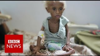 Yemen On the brink of starvation  BBC News [upl. by Irahk]