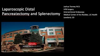 Laparoscopic distal pancreatectomy with splenectomy [upl. by Akili]