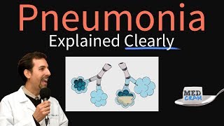 Pneumonia Explained Clearly by MedCramcom [upl. by Bounds]