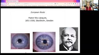 Iridology  how its history created myths that just dont want to go away [upl. by Gilbertina]