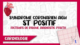 Syndrome Coronarien Aigu Segment ST Positif  Diagnostic Positif Symptomes amp ECG Complications [upl. by Keavy]