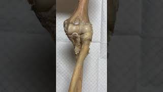 Elbow Joint [upl. by Burkhart]