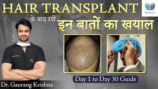 हेयर ट्रांसप्लांट के बाद क्या करे After Hair Transplant Care in 2024  Medlinks Hair Transplant [upl. by Aliahkim]