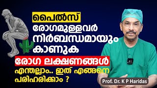 പൈൽസ് രോഗമുള്ളവർ നിർബന്ധമായും കാണുക  Piles Treatment Malayalam  Dr K P Haridas [upl. by Sedaiuqlem817]