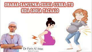 DHABAR XANUUNKA XILGA UURKA IYO SIDA LOOLA TACAALO Dr faris [upl. by Roz]