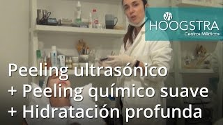 Peeling ultrasónico  Peeling químico suave  Hidratación profunda 16028 [upl. by Ticon]