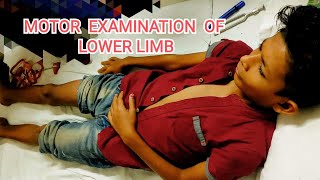 motor examination of lower limb paediatrics neurological examination lMN examinationpaediatrics [upl. by Holder]