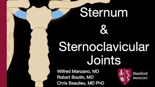 Sternum and Sternoclavicular Joints  Wilfred Manzano MD [upl. by Joiner]