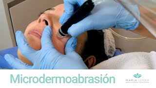 TRATAMIENTO FACIAL  Microdermoabrasión  María Linda [upl. by Lynne761]