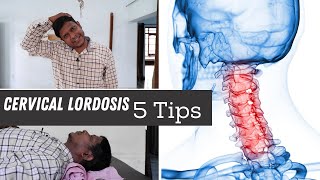 5 Best Loss of Cervical Lordosis Exercises amp Home Tips for Neck Pain [upl. by Itsyrc263]