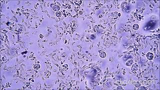 Sabin Feldman dye test Toxoplasmosis Part two Marwa Omar [upl. by Janina]