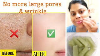 1 Week Challenge Get rid of OPEN PORES amp Wrinkles ✅ how to get glowing eventone skin [upl. by Nagam]