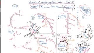 Basics of angiographic views PartII [upl. by Hanson626]