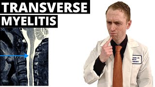 Neurologist Explains Transverse Myelitis [upl. by Salvay658]