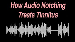 How Audio Notching Treats Tinnitus [upl. by Lister669]