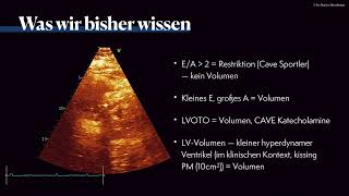 〖Ultraschall〗 ICU amp Volumenstatus 💘💫 [upl. by Leirud183]