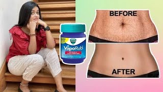 Stretch marks ൽ കുറച്ചൊക്കെ മാറ്റം പോലെ തോന്നുന്നുണ്ട് 😍 [upl. by Ahso]