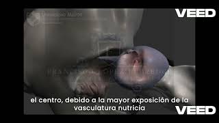 Patología del Sistema Osteoarticular  Parte 6 Displasia de Cadera en Caninos CDD [upl. by Tati273]