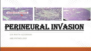 Perineural Invasion SCC  Simplified explanation  Images [upl. by Ellegna]