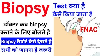 Biopsy test कैसे किया जाता है  Biopsy की रिपोर्ट कैसे देखते है  Excisional amp Incisional biopsy [upl. by Basilius]