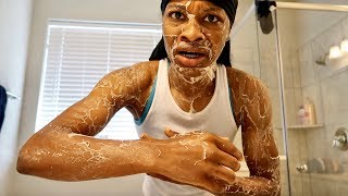 DISGUSTING SKIN PRANK ON ARMON AND TREY [upl. by Neely]