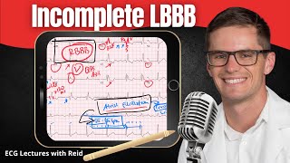 Incomplete Left Bundle Branch Block ILBBB EKG  ECG Lecture [upl. by Kask]