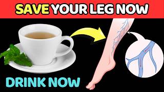 STOP YOUR KNEE PAIN 5 Teas For Your Leg Circulations  Vitality Solutions [upl. by Vento]