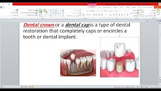 Prosthodontics 1  lec1  Dr Mahmoud [upl. by Hsevahb383]