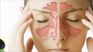 How to Use Wild Oregano Oil to Treat Sinusitis  Herbal Treatment for Sinusitis [upl. by Suaeddaht]