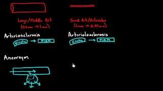 Hypertension effects on the blood vessels [upl. by Ishmul]