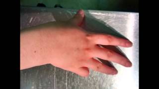 Lateralization Practice  Southlake Hand Therapy [upl. by Deery]