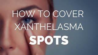 How to cover xanthelasma spots and remove them for good [upl. by Ayekat]