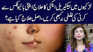 Bacterial Acne Treatment for Girls Top Tips and Tricks  Dr Sahar Chawla [upl. by Aisena]