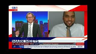 Dr Ismail Ughratdar FRCS Discusses Hair Transplants w Mark Dolan [upl. by Ahsen]