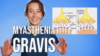 Myasthenia Gravis [upl. by Erline]