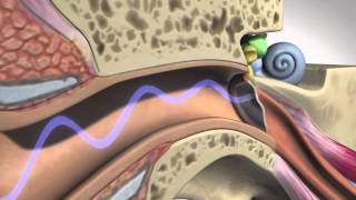 How Hearing Works  Anatomy [upl. by Charles]