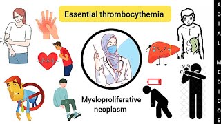 Essential thrombocythemia  Causes  Sign and symptoms  Lab diagnosis  Treatment [upl. by Hintze]