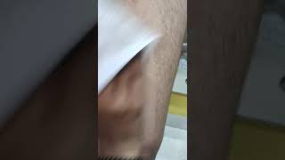 Wax skincare lipo work trending viral video viral speechviralvideos bodywax wax tips [upl. by Mcginnis768]