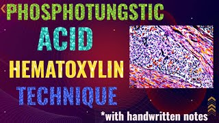 Phosphotungstic acid hematoxylin technique PTAH stain [upl. by Caldwell138]