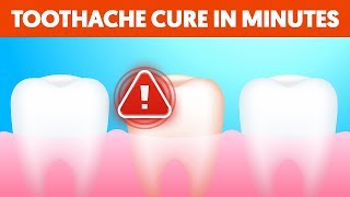 5 Ways to Stop a Toothache in MINUTES Using natural home remedies [upl. by Dickens255]