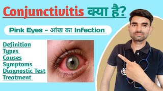 Conjunctivitis in Hindi  Causes Symptoms and Treatment of Conjunctivitis [upl. by Noy631]