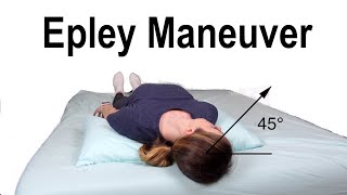 Epley Maneuver to Treat BPPV Dizziness [upl. by Ecnerwaled]