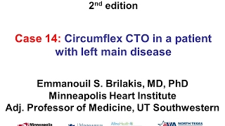 Case 14 Manual of CTO Interventions  Circumflex CTO in a patient with left main disease [upl. by Innad]