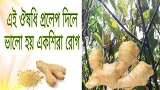 একশিরা ও হাইড্রোসিল রোগের গাছরা চিকিৎসা। [upl. by Ernie]