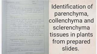 Identification of parenchyma collenchyma and sclerenchyma tissues in plants from prepared slides [upl. by Suoivatnom456]